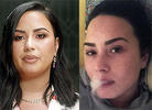 Demi Lovato's Blues: Singer Reveals Struggles After Near-Fatal OD